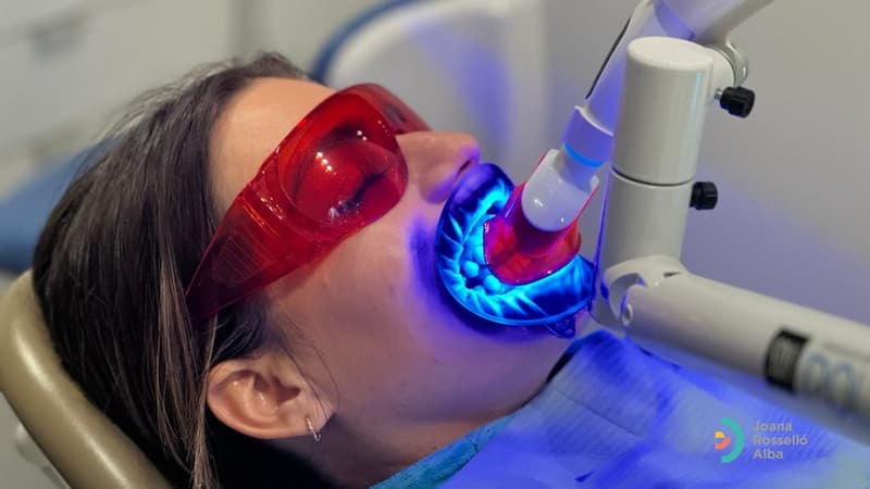 blanqueamiento dental en Manacor
